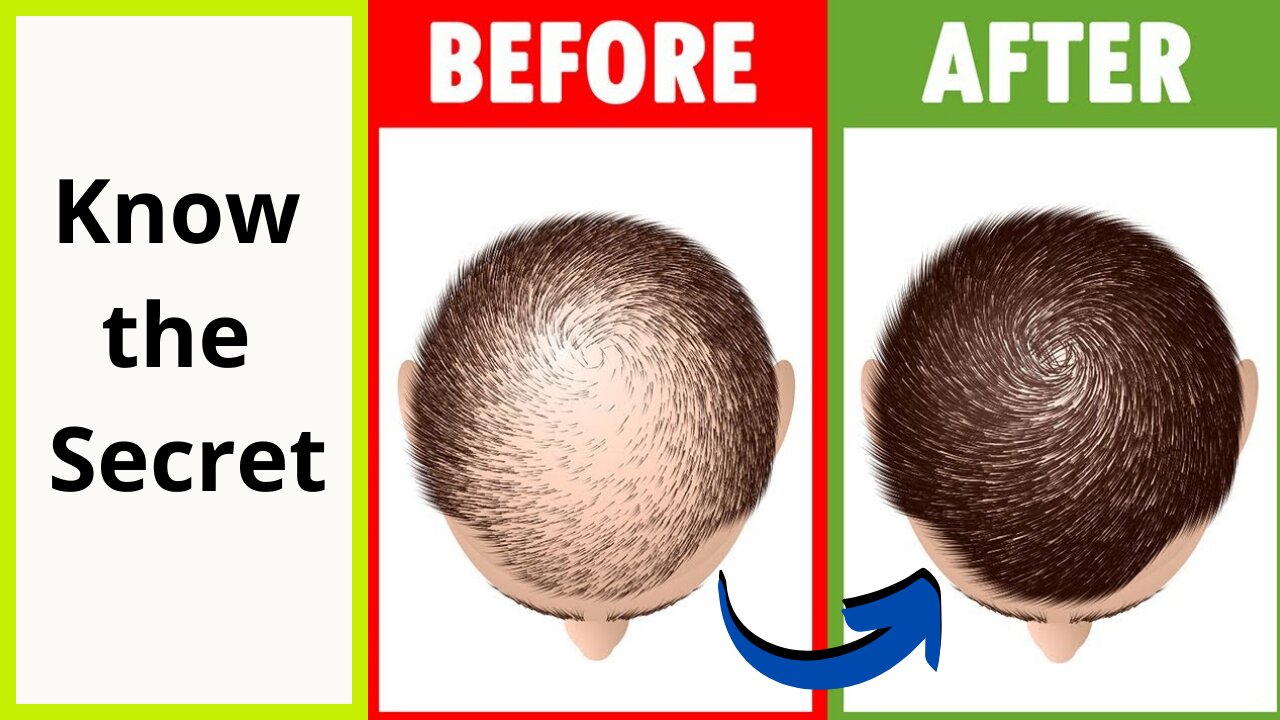 12 Home Remedies to Prevent Hair Loss and Regrow Your Hair