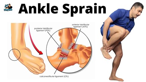 Ankle Sprain Exercises Early Stage