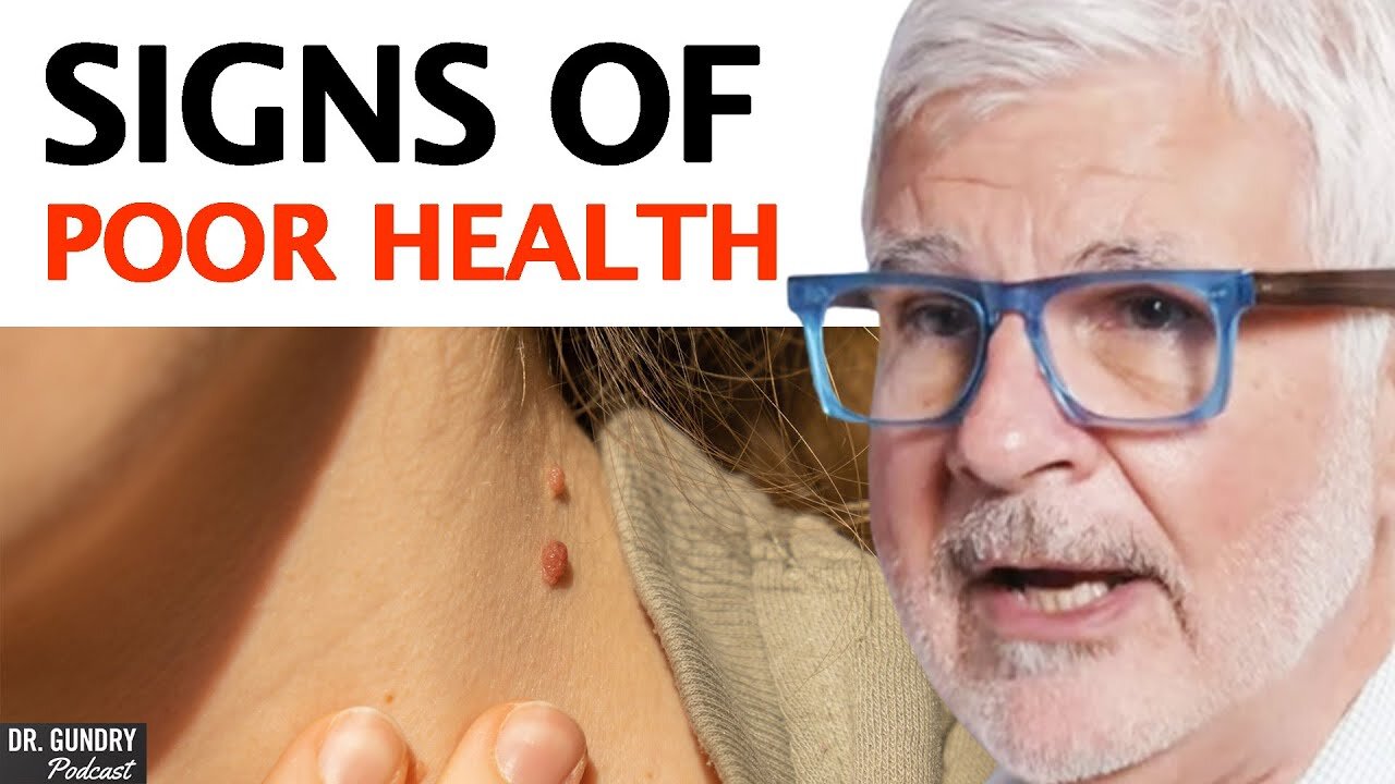 4 WARNING SIGNS You Need To Go To Your DOCTOR! _ Dr. Steven Gundry