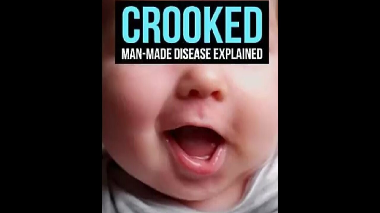 Vaccines-Heavy-Metals-Lopsided Faces-Eyes-Man Made Disease Explained