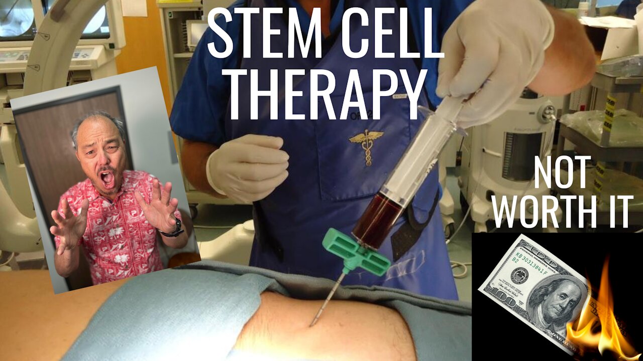 $20,000 Stem Cell Therapy is USELESS for Low Back Pain