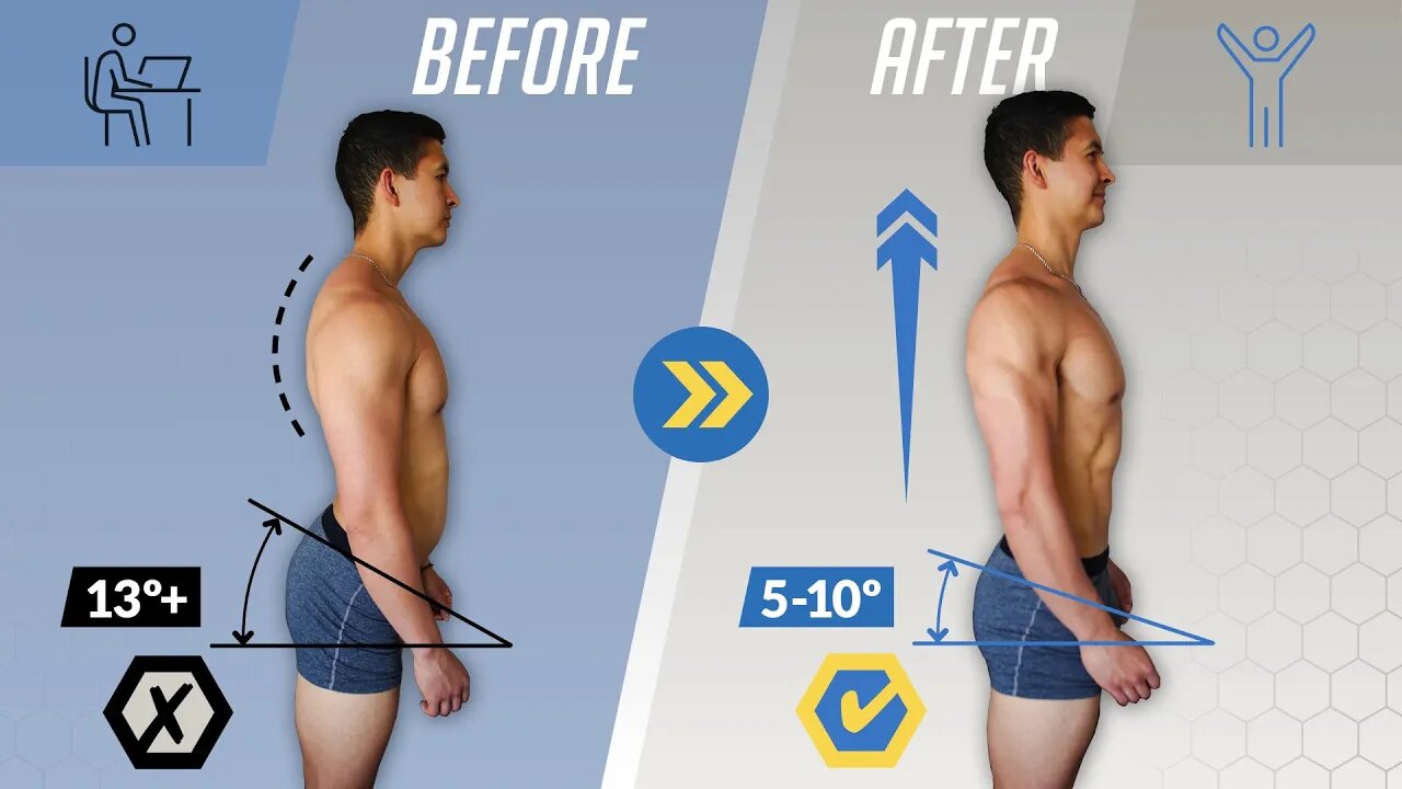 Fix -Anterior Pelvic Tilt- in 10 Minutes_Day (Daily Exercise Routine)