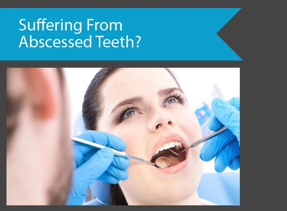 Suffering From Abscessed Teeth