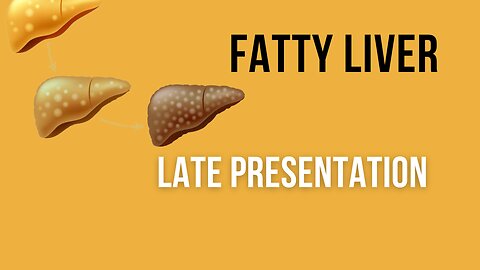 Fatty liver signs