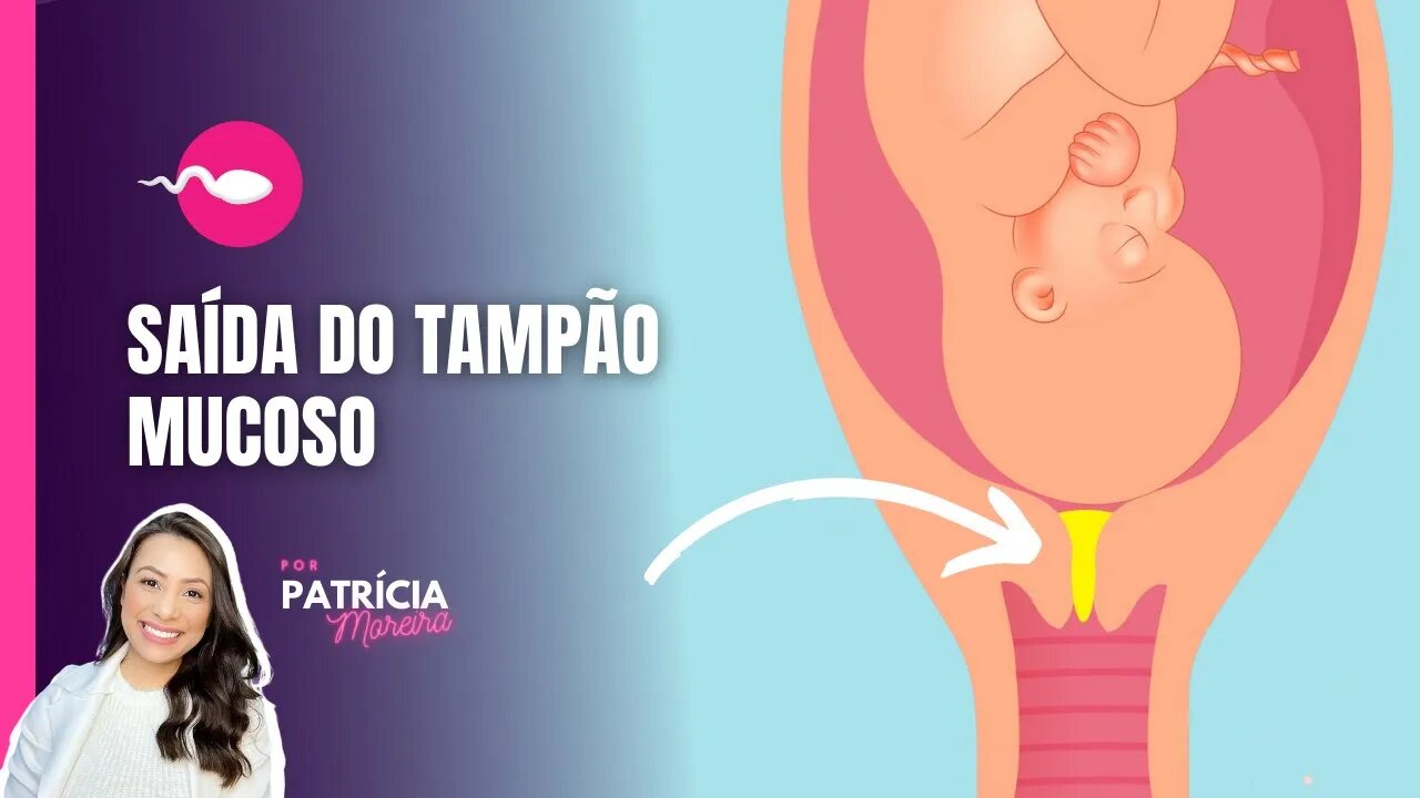 TAMPÃO MUCOSO | Como saber se o tampão saiu? O que fazer depois que o tampão sair? | Boa Gravidez