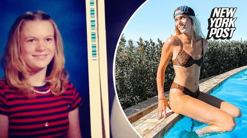 I'm a hot doctor — but I wasn't always a perfect 10