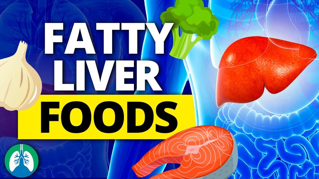 TOP 10 FOODS TO COMBAT A FATTY LIVER NATURALLY