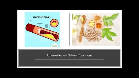 Atherosclerosis Natural Treatment