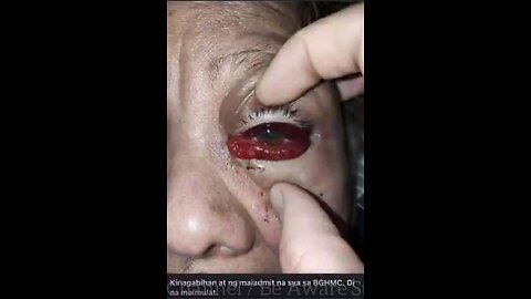 Part 2 of 3- Artificial Life Forms in the "vaccine", chipped, Brainwashed, BIBLICAL