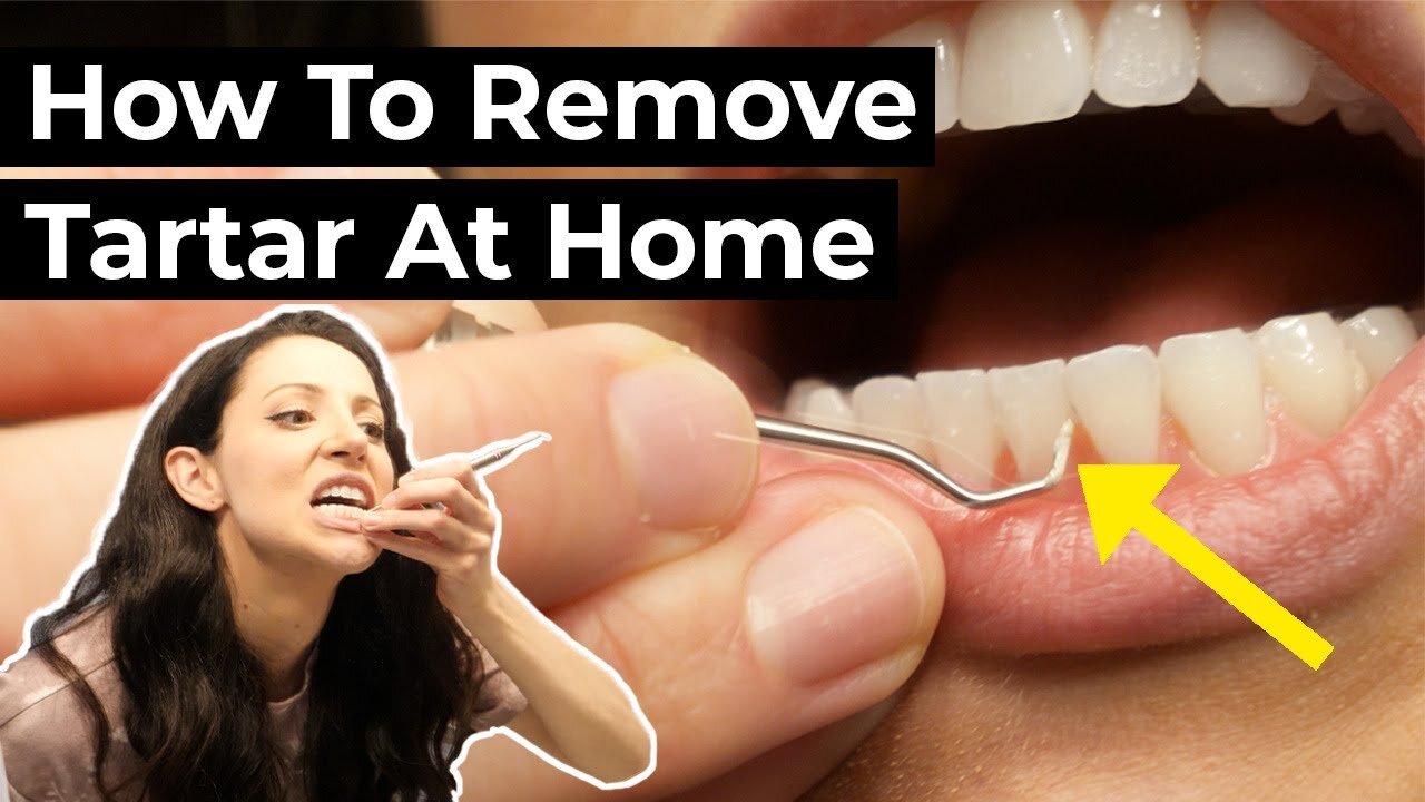 How to Get Rid of Plaque - Home Remedies for Plaque and Tartar