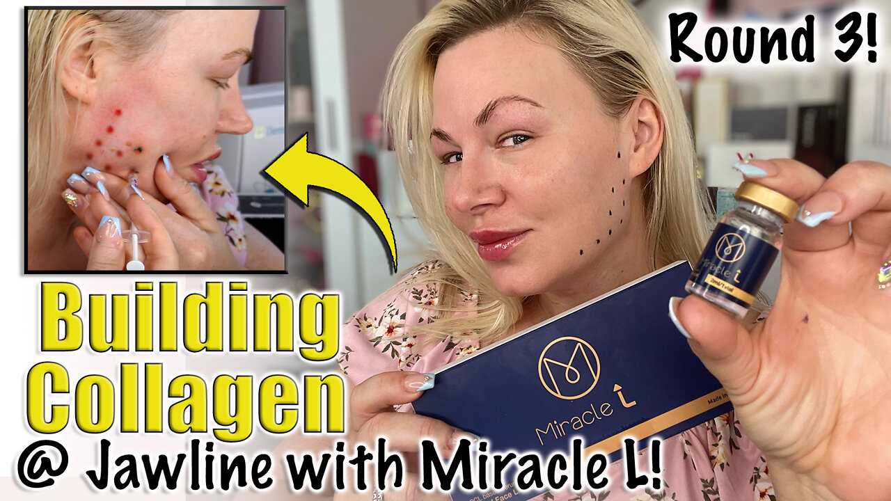 Building Collagen win Jawline with Miracle L: Round 3 from Acecosm.com | Code Jessica10 Saves you $$