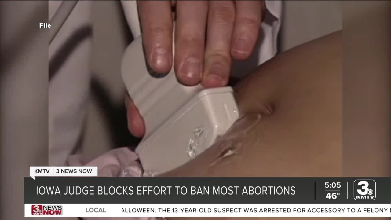 Iowa abortion ban blocked by district court; appeal expected next