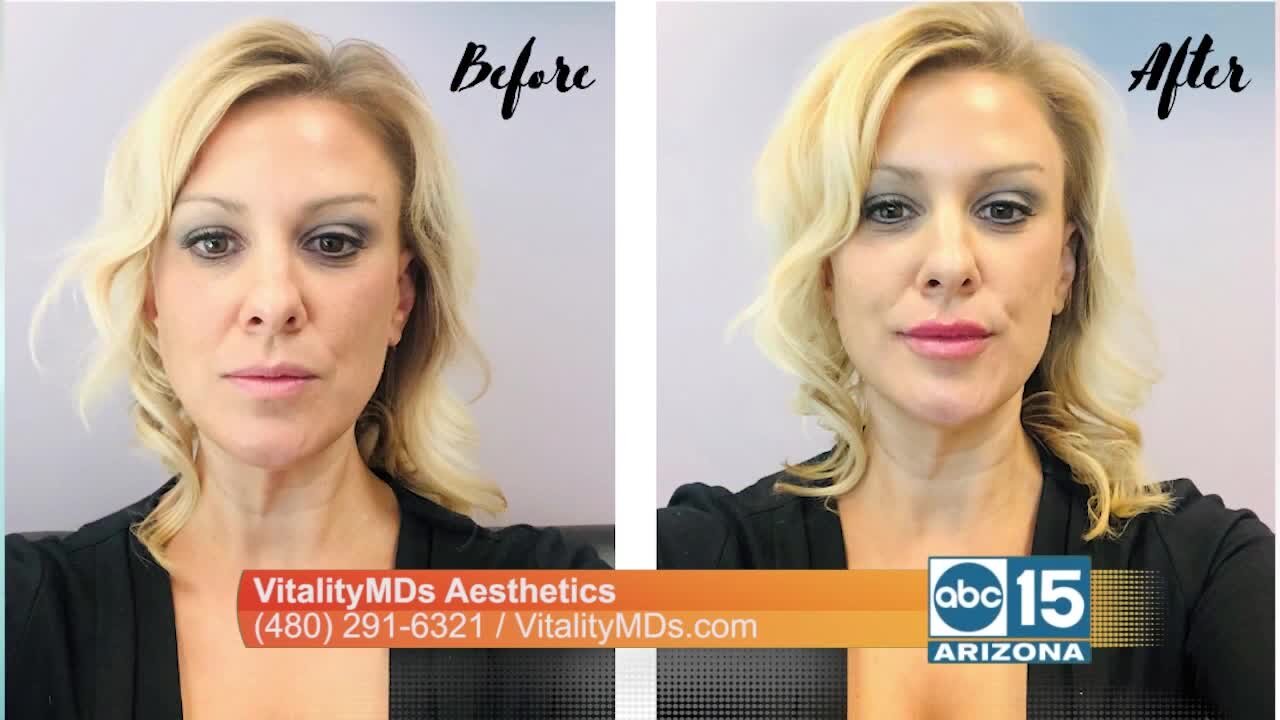 You can look amazing with injectable treatments offered at VitalityMDs Aesthetics