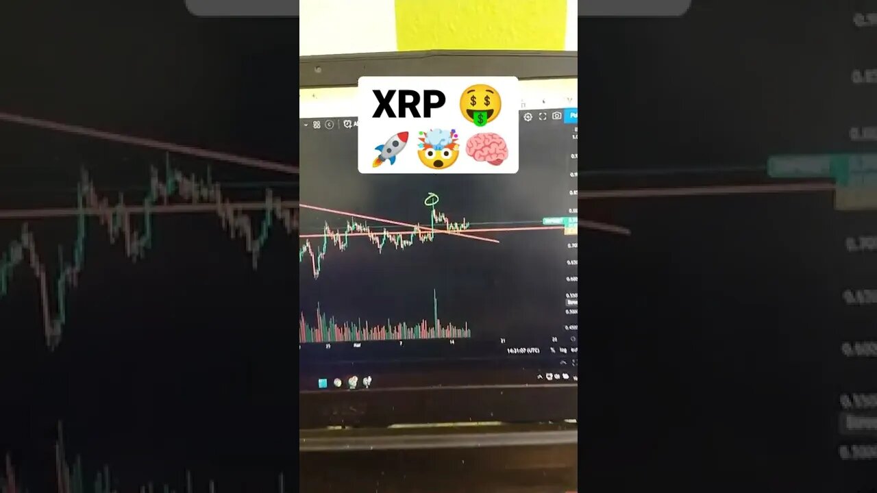 XRP 🤯🧠😎 Crypto Trading #shorts