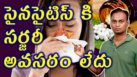 సైనసైటిస్ కి సర్జరీ అవసరం లేదు | Best homeopathy Treatment for Sinusitis | డా. భరద్వాజ్ | హోమియోపతి
