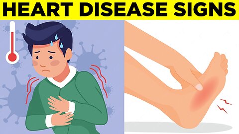 15 Early Warning Signs Of Heart Disease You Should Lookout For