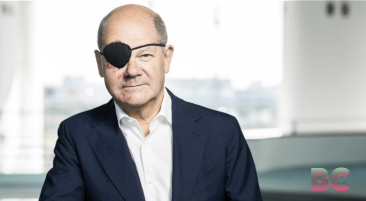 German Chancellor Scholz tweets picture of himself with black eye patch after jogging accident