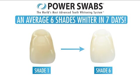 Achieve Whiter Teeth // Power Swabs