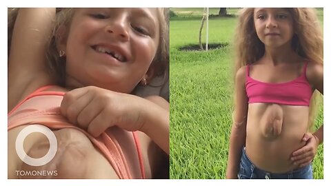 Girl born with heart outside chest: 8-year-old suffers from rare congenital condition - TomoNews