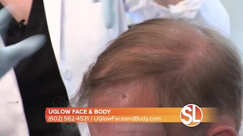 Hair falling out? UGlow Face & Body offers medical-grade PRP for hair restoration