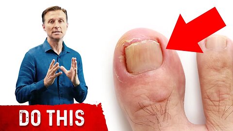 The Causes of Ingrown Toenails