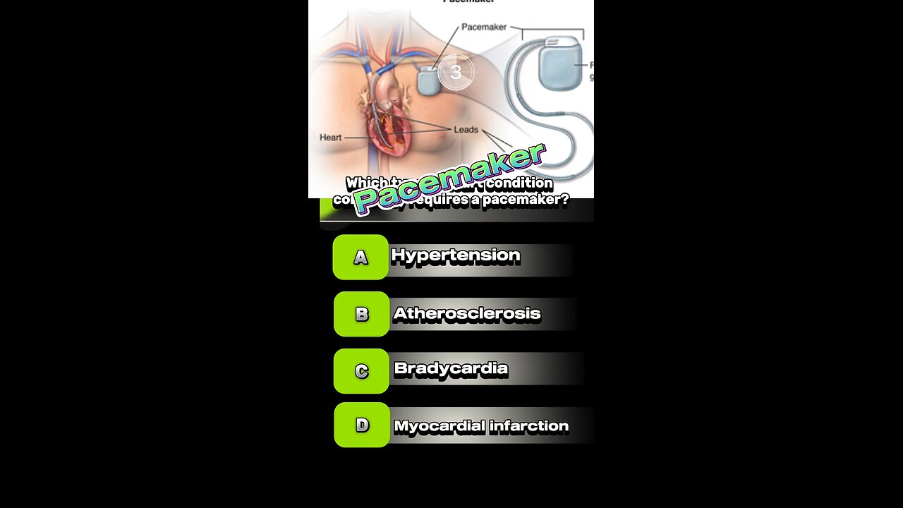 Pacemaker of heart mcqs #bypasssurgery #heart #pharmacologyexam 🫀#bradycardia #heartblock #MRI