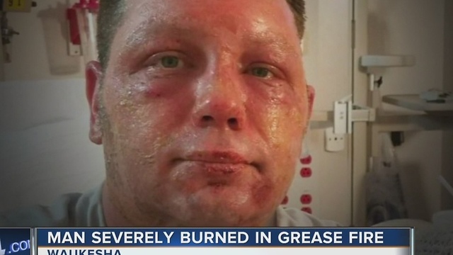 Deep fryer grease fire nearly kills father of three