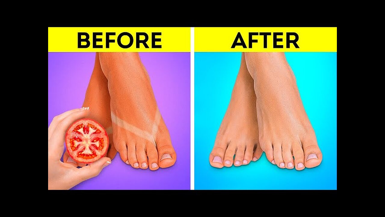 Foot Care Hacks 🦶👣 Smart Hacks To Keep Your Feet Nice And Smooth