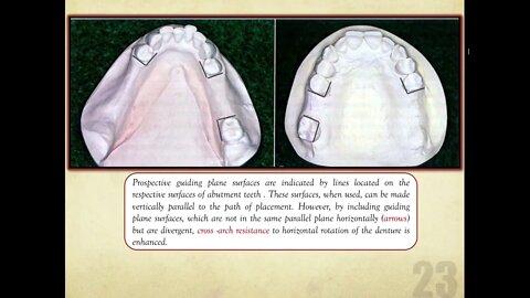 Prosthodontics L4 part2 (Dental Surveyor And Surveying)