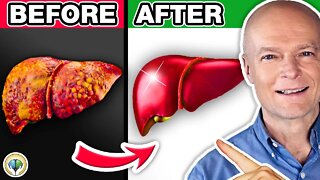 #1 Absolute Best FATTY LIVER DETOX