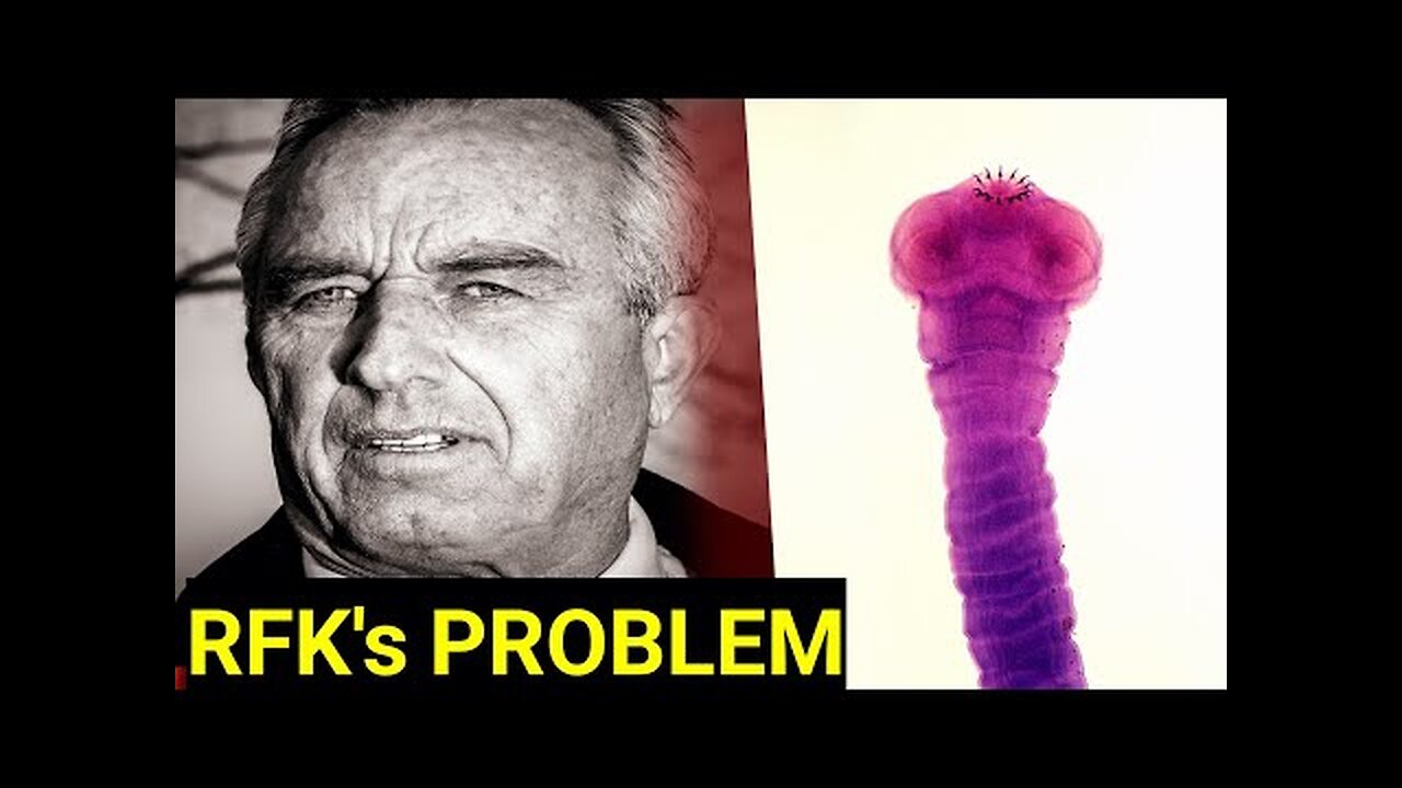 Strange Conspiracy Theory About RFK Jr`s Brain Worm