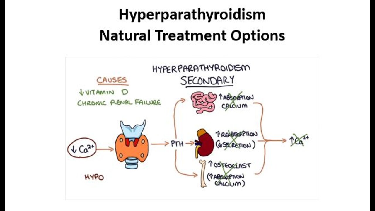 Hyperparathyroidism - Natural Treatment Options