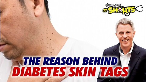 #SHORTS - How does Diabetes cause Skin Tags (& other skin problems)