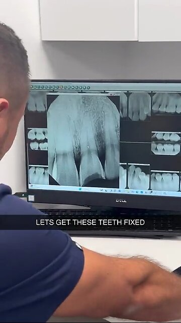 SNEAKO AT THE DENTIST