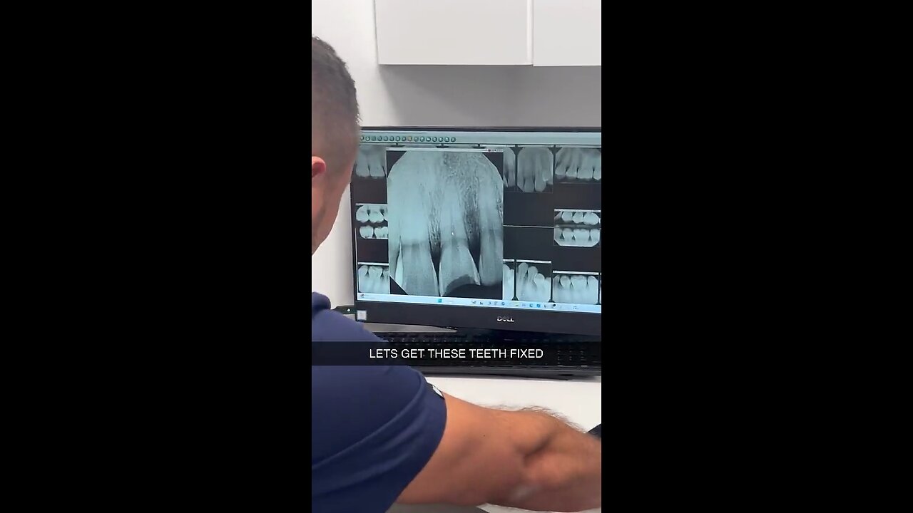 SNEAKO AT THE DENTIST
