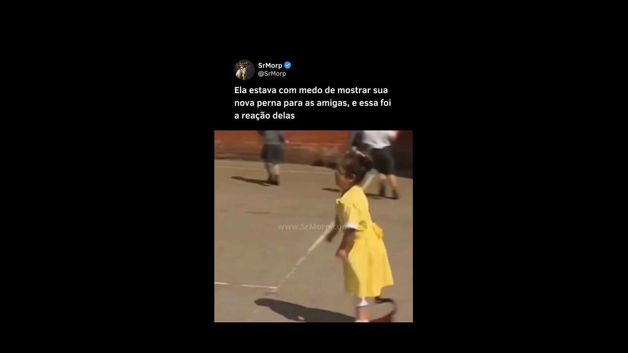 Ela tava com medo de mostrar sua nova prótese