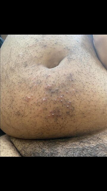 Dj Akademiks Fat Funky Bumpy Stomach Ass Keeps Getting My Video Removed from Youtube