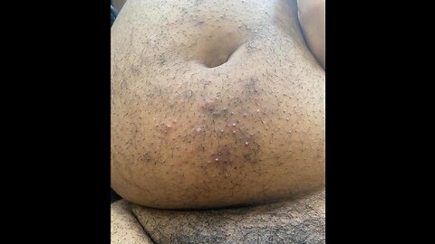 Dj Akademiks Fat Funky Bumpy Stomach Ass Keeps Getting My Video Removed from Youtube