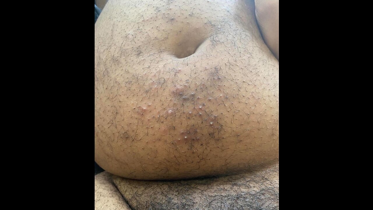 Dj Akademiks Fat Funky Bumpy Stomach Ass Keeps Getting My Video Removed from Youtube