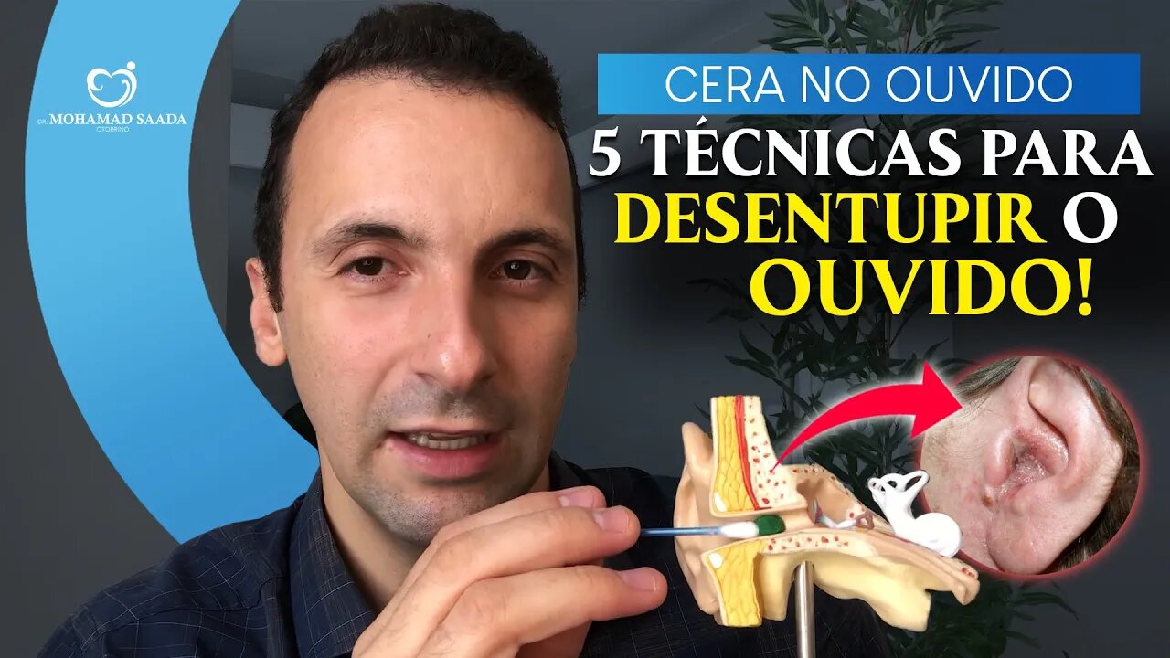 Como Desentupir o Ouvido e Quanta Cera Retirar. 5 Técnicas diferentes, e como deve limpar em casa !