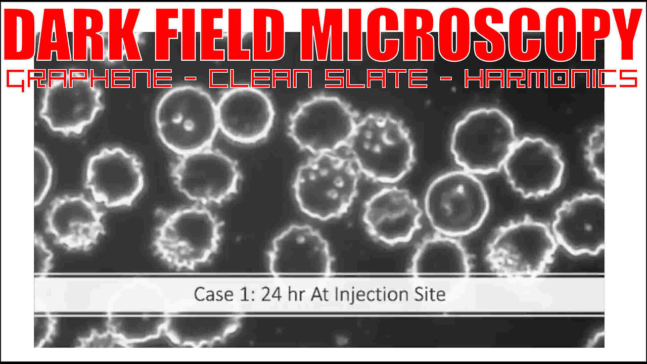 Darkfield Microscopy, Graphene, Clean Slate, Harmonics