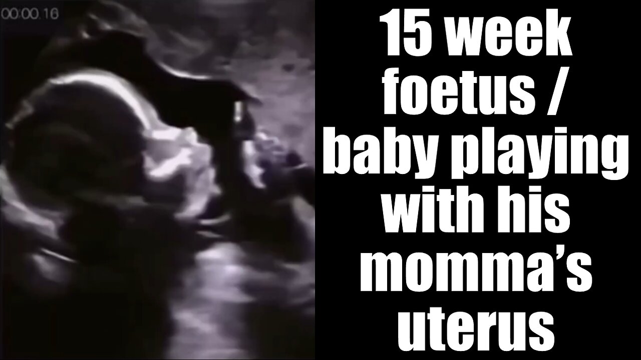 15 WEEK OLD BABY FETUS PLAYING (32SECS)