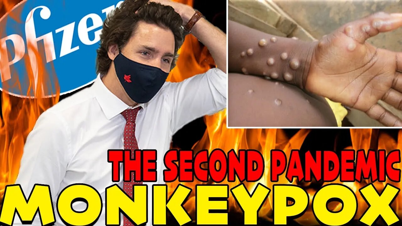 BREAKING NEWS - MONKEY POX IS HERE!!!