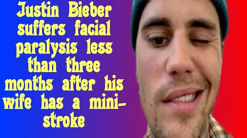 Justin Bieber reveals that he is suffering from a condition called Ramsay Hunt syndrome