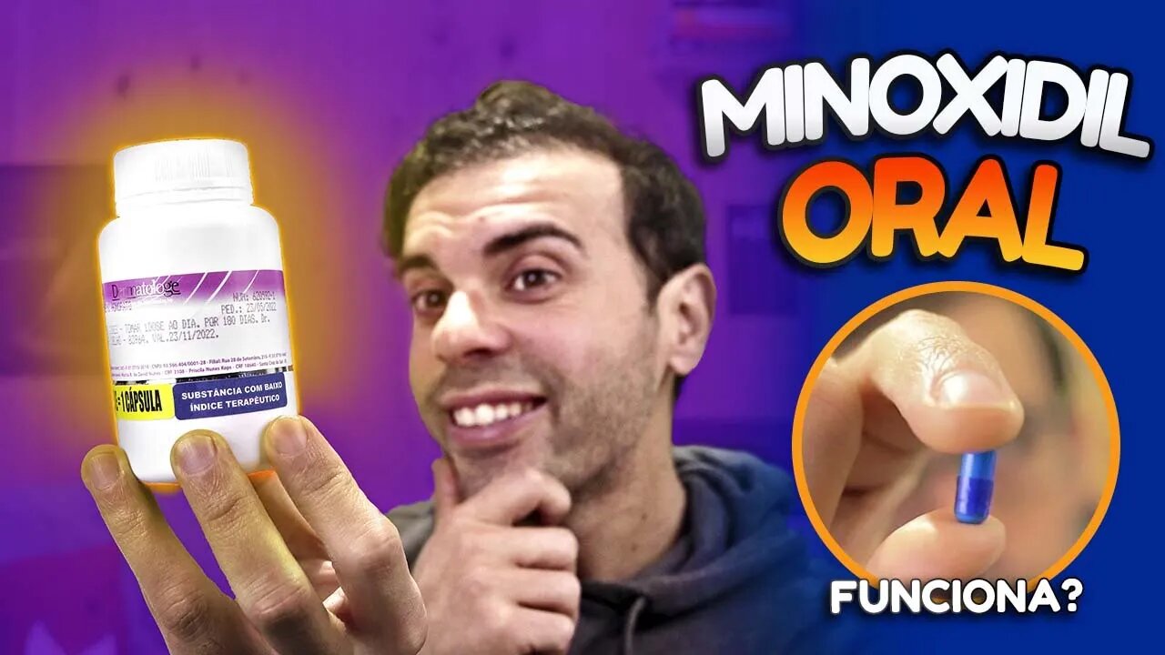 Minoxidil Oral, alternativa que os homens calvos precisam conhecer