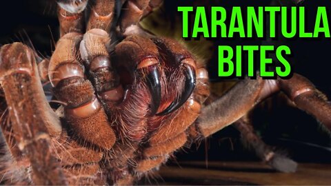 TARANTULA BITE: First Aid, Symptoms & Prevention