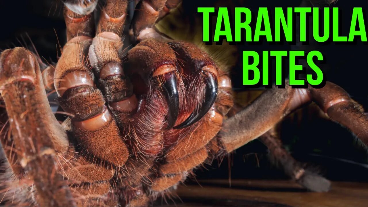 TARANTULA BITE: First Aid, Symptoms & Prevention