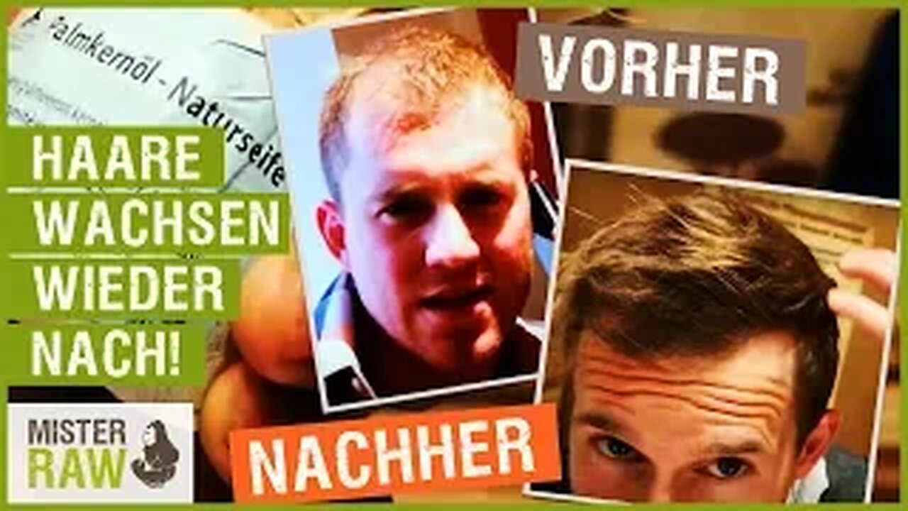 Haare wieder nachgewachsen: Vorher-Nachher Vergleich: Mit dieser Seife geht´s!