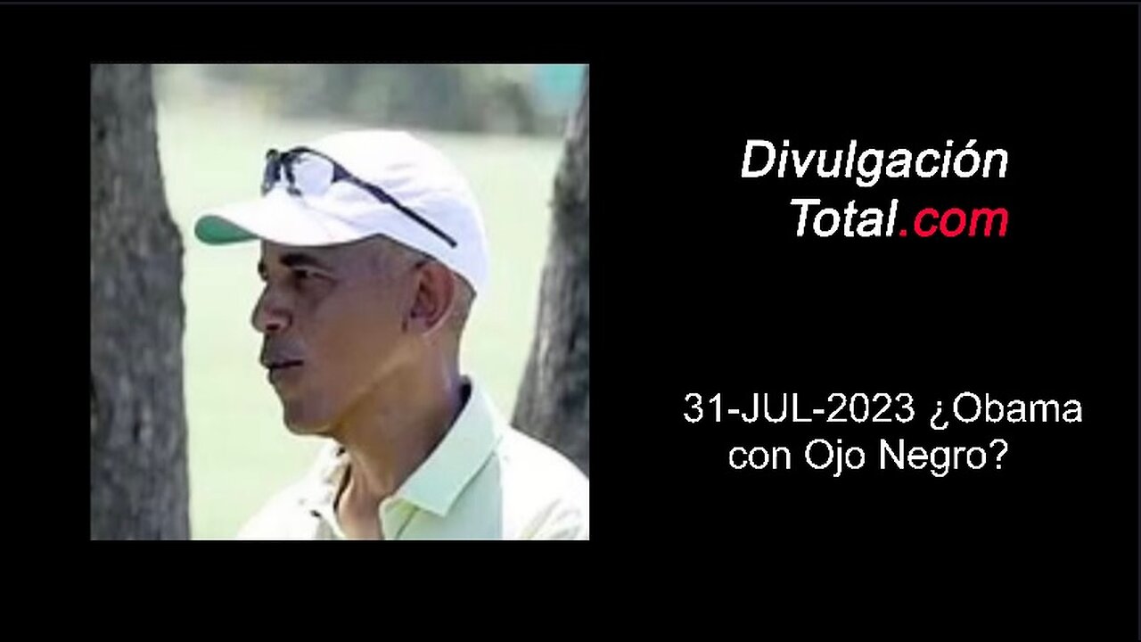 31-07-2023 ¿Obama con Ojo Negro?