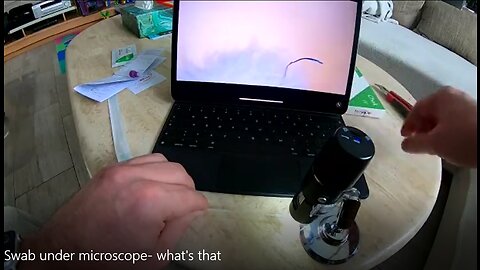 Swab under microscope- what's that?